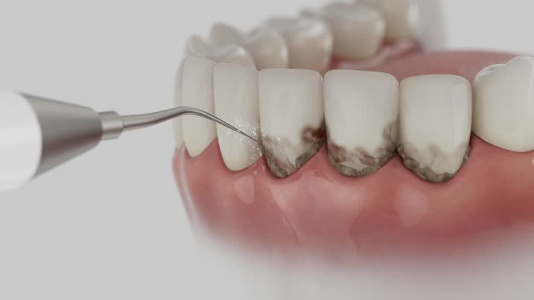 Trusted Teeth Cleaning And Checkup service in Fords, NJ - Dentist Open Now
